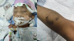 中国三岁男童被生父女友虐待致死 生父却要前妻撤案